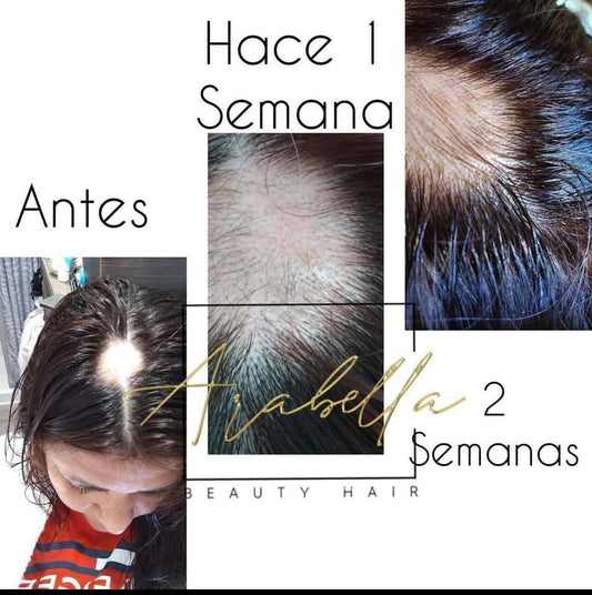 Kit Crecimiento Capilar con Biotina (Shampoo y Acondicionador)